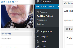 Patient Before/After Gallery Plugin